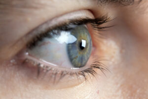 La-disfuncion-lagrimal-o-sindrome-del-ojo-seco-–-Salud.jpg