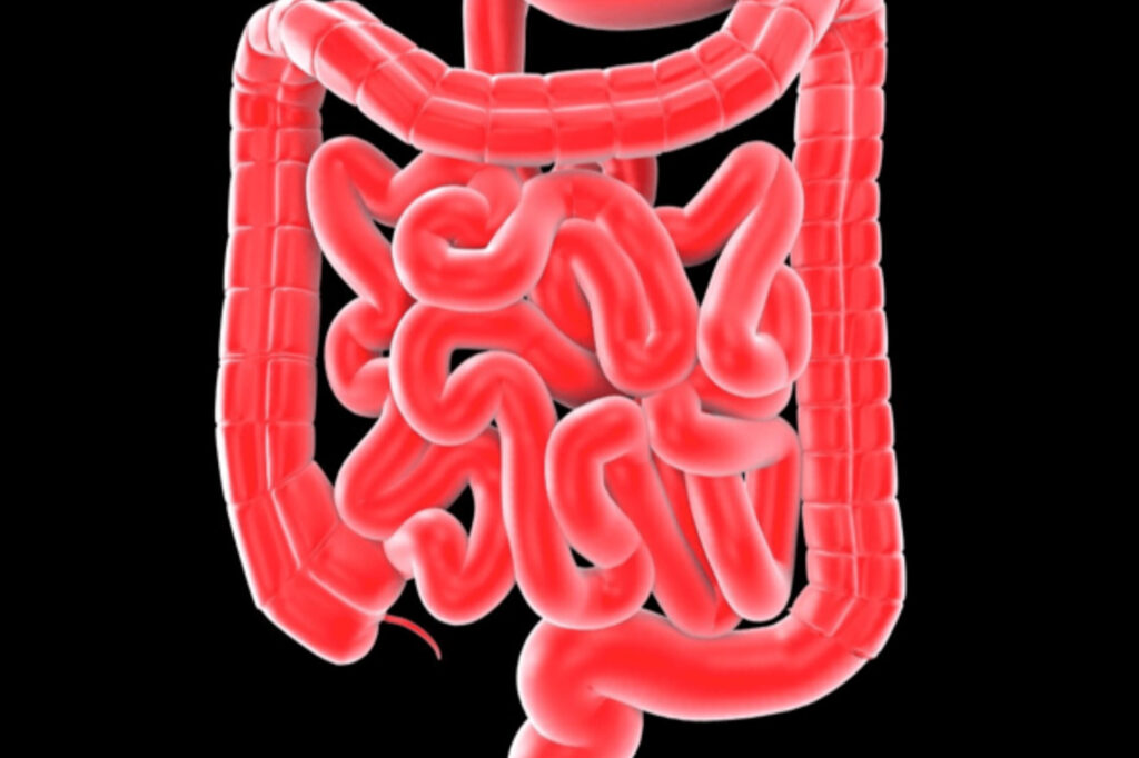 Las-enfermedades-inflamatorias-del-intestino-podrian-detectarse-al-nacer-–.jpg