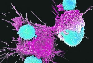 Protonterapia-el-tratamiento-contra-el-cancer-que-evita-secuelas-de.jpg