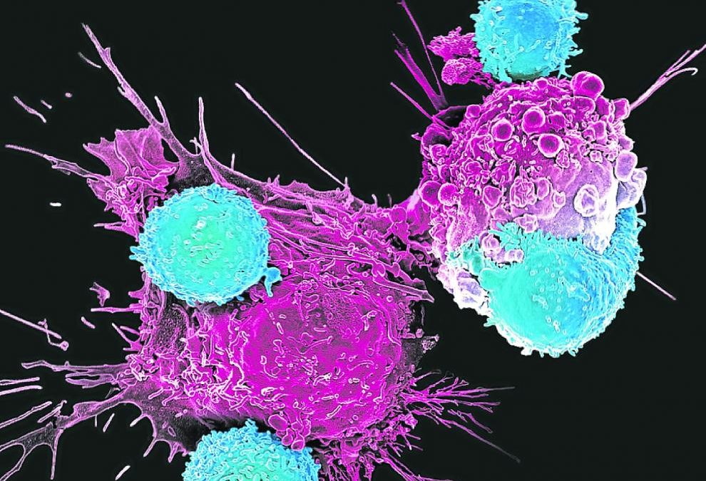 Protonterapia-el-tratamiento-contra-el-cancer-que-evita-secuelas-de.jpg
