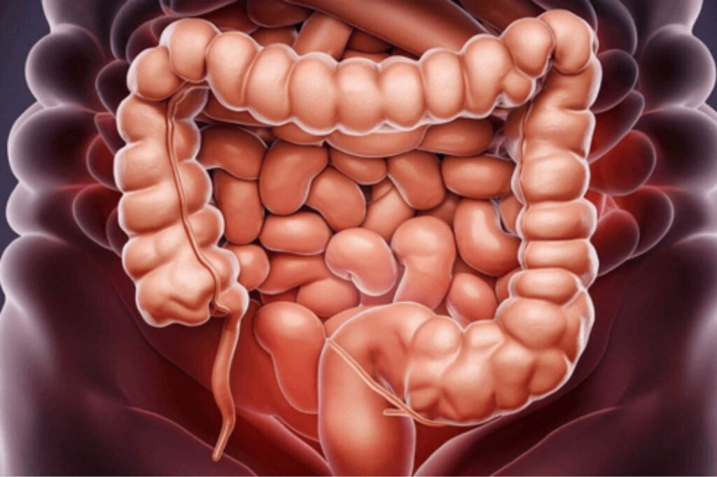 Se-sospecha-de-dos-cepas-dominantes-de-E-coli-como.jpg