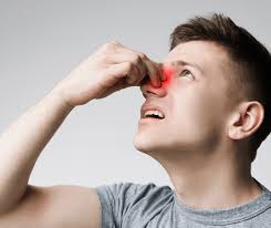 La-poliposis-nasal-el-bloqueo-nasal-constante-impacta-en-la.jpg