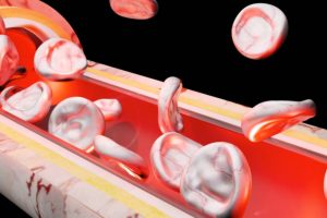 Identifican-nuevas-variantes-geneticas-que-aumentan-el-riesgo-de-aterosclerosis.jpg