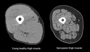 Efectos-de-diferentes-modalidades-de-ejercicio-sobre-la-sarcopenia.jpg