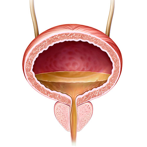 Una-biopsia-liquida-mejora-el-tratamiento-del-cancer-de-vejiga.jpg