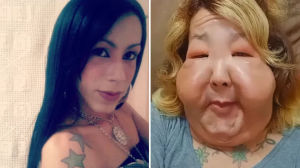 Una-influencer-inicio-un-tratamiento-de-recuperacion-tras-un-procedimiento.png