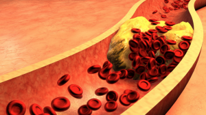 La-deficiencia-en-colesterol-materno-aumenta-el-riesgo-de-cardiopatia.png