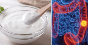 El-consumo-de-yogur-se-asocia-a-menor-incidencia-de.png