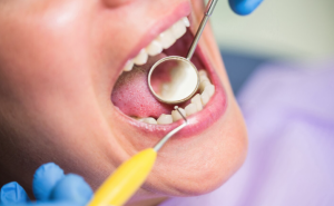 La-periodontitis-como-senal-de-alarma-mas-alla-de-la.png