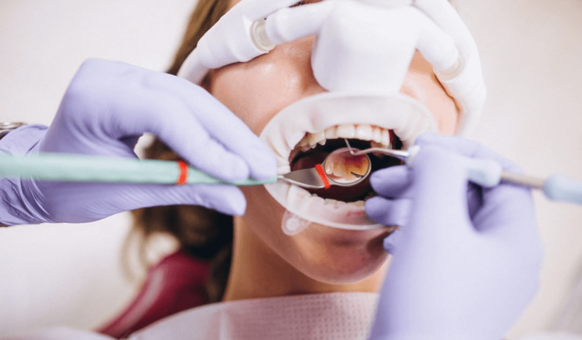 Las-enfermedades-cardiovasculares-y-su-relacion-con-las-infecciones-dentales.png