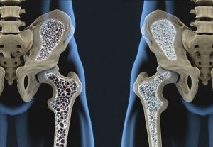 Osteosarcopenia-y-fragilidad-Fisiologia-del-Ejercicio-by-Dr-Lopez.jpg