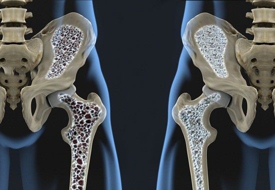 Osteosarcopenia-y-fragilidad-Fisiologia-del-Ejercicio-by-Dr-Lopez.jpg