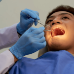 El estrés mecánico acelera la pérdida ósea en la periodontitis – Salud y Medicina