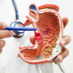 La prevención, el diagnóstico y los avances terapéuticos, claves para la detección precoz del cáncer digestivo – Salud y Medicina