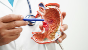 La-prevencion-el-diagnostico-y-los-avances-terapeuticos-claves-para.png